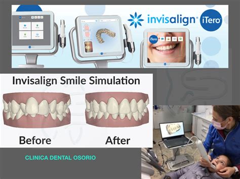 dental doc digital osorio
